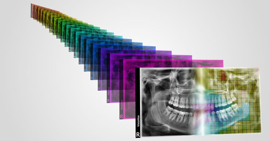VistaVox_Produkt_Feature1