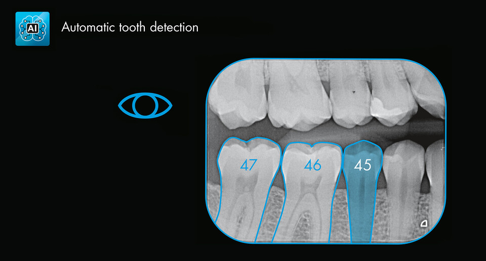 M-automatic_tooth_detection